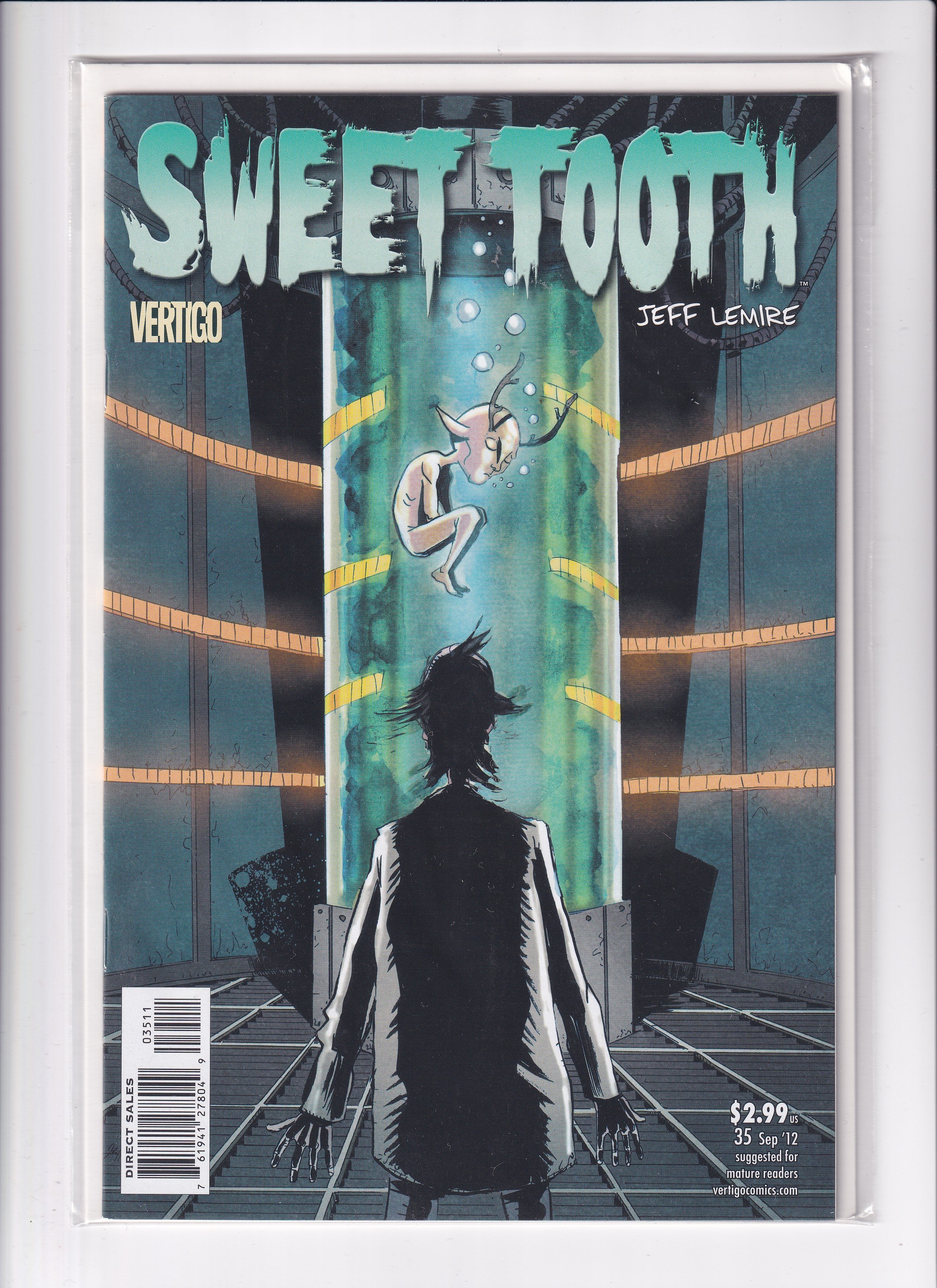 SWEET TOOTH #35 - Slab City Comics